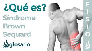 BROWN - SEQUARD | Qué es, qué estructuras afecta, síntomas, signos, causas y tratamiento