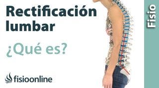 33# Rectificación o inversión de la curvatura lumbar. Qué es, causas y tratamiento.