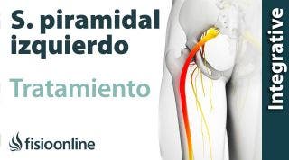 Tratamiento del Sindrome Piramidal izquierdo