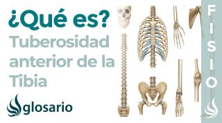 TUBEROSIDAD TIBIAL| Qué es, ubicación, qué se inserta en esta estructura y qué produce dolor