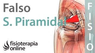 Síndrome del piramidal. ¿Cómo diferenciar un caso falso de uno verdadero?