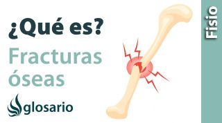 FRACTURAS ÓSEAS | ¿Qué es?