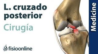 CIRUGÍA del LIGAMENTO CRUZADO POSTERIOR