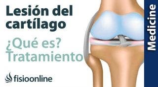 ¿Qué es y cómo se lesiona el cartílago?