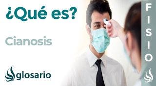 CIANOSIS | Qué es, características, en qué patologías aparece, por qué y cómo se produce