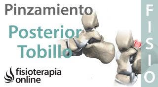 Os Trigonum o pinzamiento posterior del tobillo - Qué es, cómo se diagnostica y tratamiento