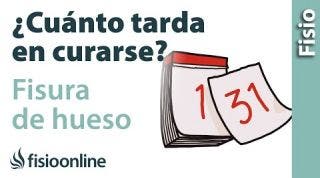 Cuánto tarda en curarse una FISURA DE HUESO