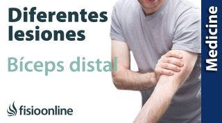 Conoce las diferentes lesiones del Bíceps distal