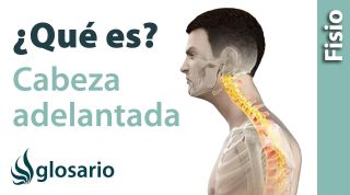 CABEZA ADELANTADA | ¿Qué es?