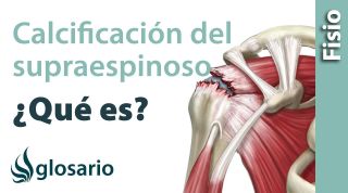 CALCIFICACIÓN DEL SUPRAESPINOSO | ¿Qué es?