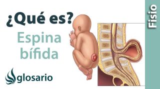ESPINA BÍFIDA | ¿Qué es?