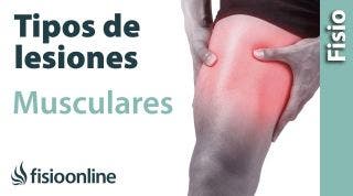 Tipos o grados de LESIONES MUSCULARES y su tratamiento y recuperación