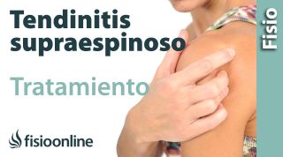 Tratamiento para la Tendinopatía del supraespinoso del hombro.