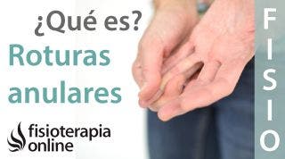 Roturas anulares o del anillo fibroso discal. ¿Qué es?