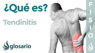 TENDINITIS | Qué es, qué estructuras afecta, síntomas, signos, causas y tratamiento fisioterapéutico