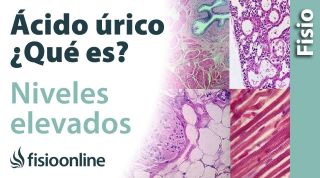ÁCIDO ÚRICO | Qué es, de dónde proviene, cómo se mide, cómo bajar niveles elevados y enfermedades