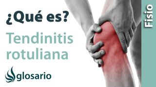 TENDINITIS ROTULIANA | ¿Qué es?