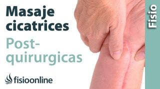 14.Auto-masaje para las cicatrices post-quirúrgicas.