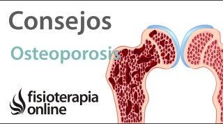10 Consejos para tratar y prevenir la osteoporosis