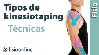 4 Técnicas del Kinesiotaping
