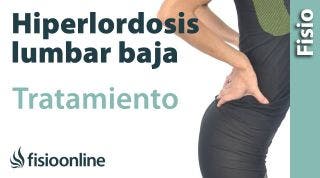 31# Hiperlordosis lumbar baja. Qué es, causas, síntomas y tratamiento.
