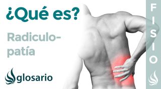 RADICULOPATÍA | Qué es, qué afecta, síntomas, signos clínicos, causas y tratamiento fisioterapéutico
