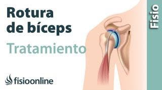 15 Rotura de biceps humeral. Qué es, causas, síntomas y tratamiento.