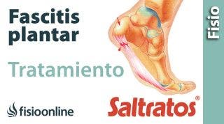 Fascitis plantar: Ejercicicios, masajes y consejos para su tratamiento.