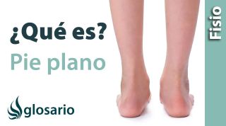 PIE PLANO | ¿Qué es?