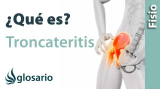 TROCANTERITIS | ¿Qué es?