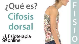 35# Cifosis dorsal. Hipercifosis y dorso plano. Qué son y cual es su importancia.