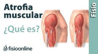 Atrofia muscular - Qué es y cómo sucede