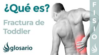 FRACTURA de TODDLER | Qué es, qué estructuras afecta, síntomas, signos, causas y tratamiento