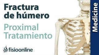 Fracturas de húmero proximal. Tratamiento quirúrgico y conservador