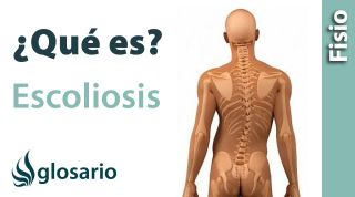 ESCOLIOSIS | ¿Qué es?
