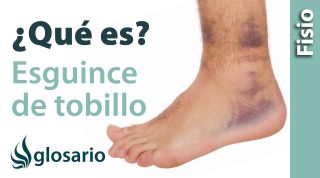 ESGUINCE DE TOBILLO | ¿Qué es?