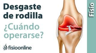 arttrosis de rodilla:  cuándo operarse y pornerse una protesis