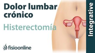 histerectomía y su relación con el dolor lumbar crónico o lumbalgia