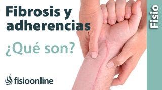 49# Fibrosis y adherencias en lesiones y heridas. Qué es, causas e importancia.