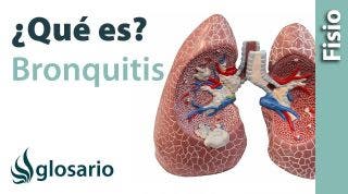 BRONQUITIS | Qué es, qué estructuras afecta, síntomas, signos, causas y tratamiento fisioterapéutico