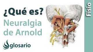 NEURALGIA DE ARNOLD | ¿Qué es?