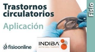 Falta de riego, edema, trombosis… Aplicación de INDIBA ACTIV en los trastornos circulatorios