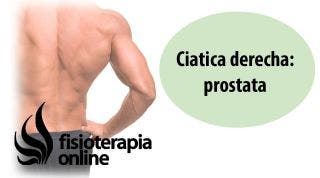 Cíatica o ciatalgia derecha y su relación con la disfunción de próstata