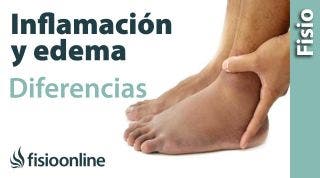 Inflamación y edema - Diferencias y características