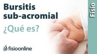 Bursitis sub acromial o del hombro