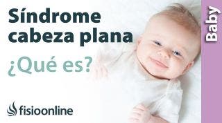 Síndrome de la cabeza plana o plagiocefalia del bebé