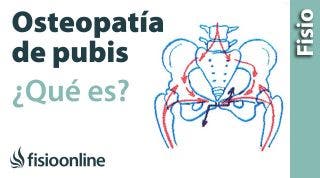 12# Pubalgia u Osteopatia de pubis. Qué es, causas, síntomas y tratamiento.