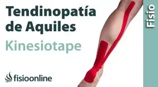 14 Kinesiostaping en la tendinopatia de Aquiles