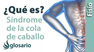 SÍNDROME DE LA COLA DE CABALLO | ¿Qué es?