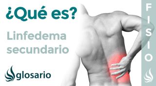 LINFEDEMA SECUNDARIO | Qué es, qué afecta, síntomas, causas y tratamiento fisioterapéutico